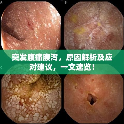突发腹痛腹泻，原因解析及应对建议，一文速览！